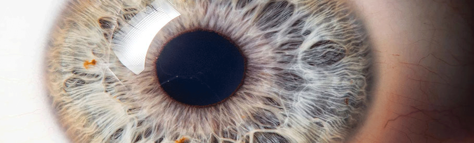 IRIDOLOGIE::"Les yeux sont le miroir de l'âme" : Hyppocrate